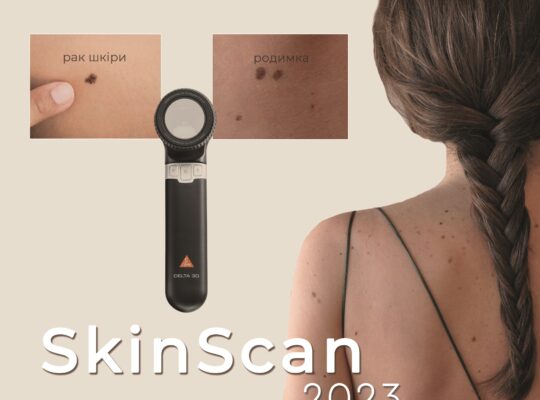 Безкоштовна діагностика новоутворень шкіри від проєкту  SkinScan. Я бережу свою шкіру у ТРЦ DREAM🔎